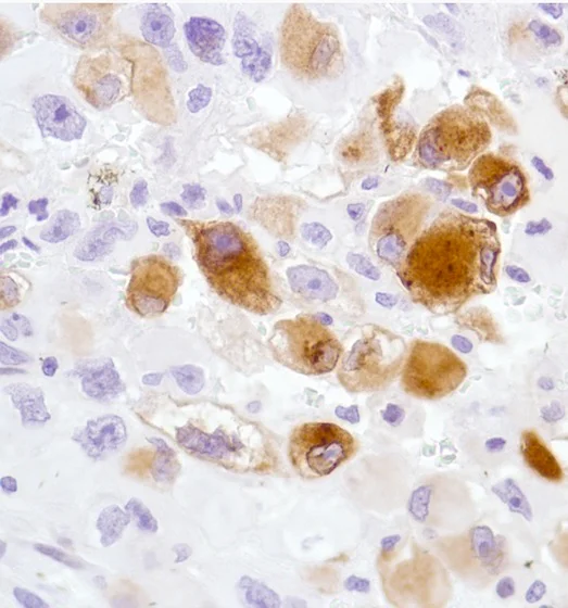 Immunohistochemistry (Formalin/PFA-fixed paraffin-embedded sections) - Anti-TN-X antibody [SP230] - BSA and Azide free (AB271942)
