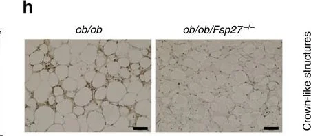 Immunohistochemistry - Anti-TNF alpha antibody [52B83] (AB1793)