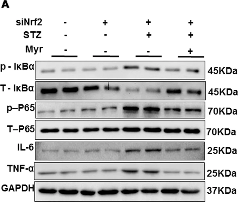 Western blot - Anti-TNF alpha antibody (AB34674)