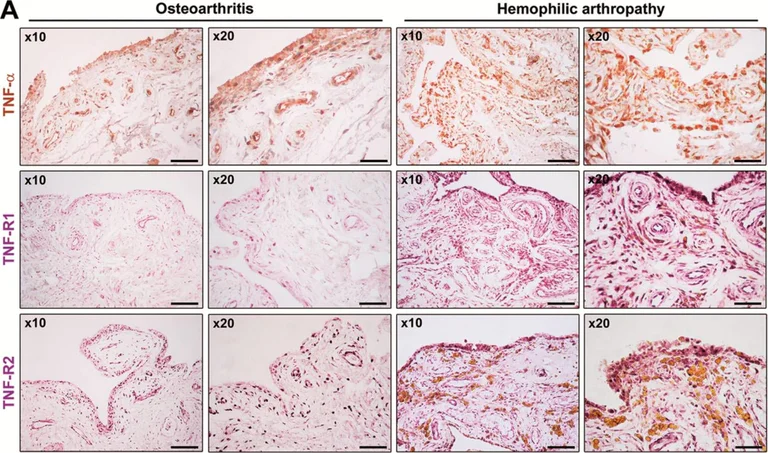 Immunohistochemistry (Formalin/PFA-fixed paraffin-embedded sections) - Anti-TNF alpha antibody (AB6671)