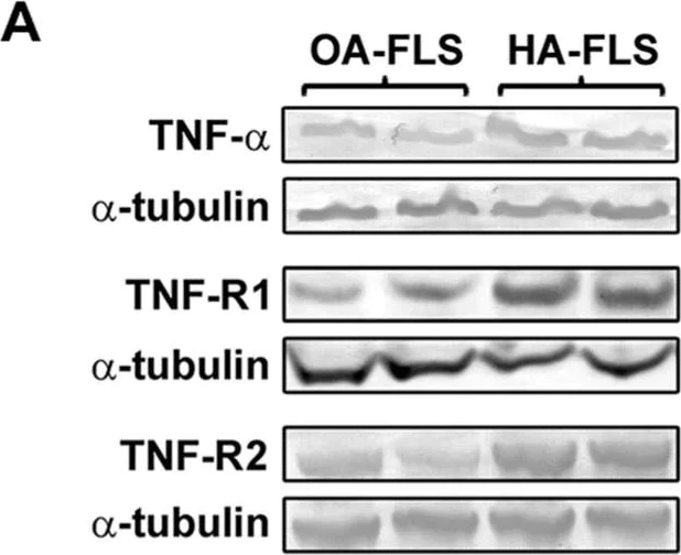 Western blot - Anti-TNF alpha antibody (AB6671)