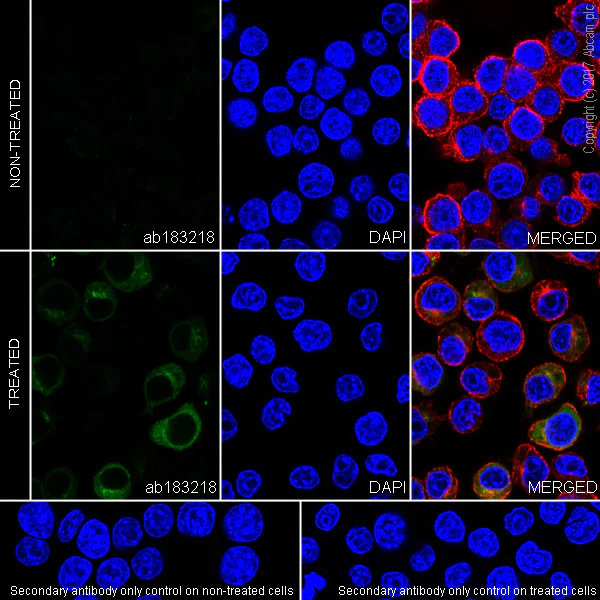 Immunocytochemistry/ Immunofluorescence - Anti-TNF alpha antibody [EPR19147] - Low endotoxin, Azide free (AB222500)