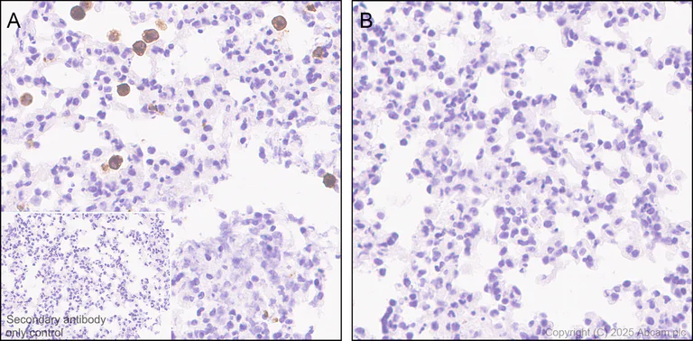 Immunohistochemistry (Formalin/PFA-fixed paraffin-embedded sections) - Anti-TNF alpha antibody [EPR20972] (AB215188)