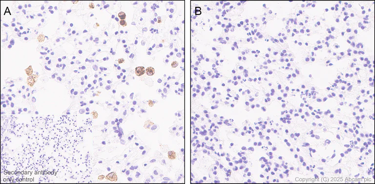 Immunohistochemistry (Formalin/PFA-fixed paraffin-embedded sections) - Anti-TNF alpha antibody [EPR20972] (AB215188)