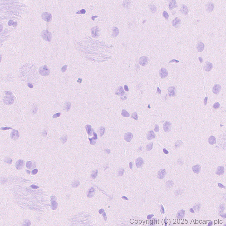 Immunohistochemistry (Formalin/PFA-fixed paraffin-embedded sections) - Anti-TNF alpha antibody [EPR20972] (AB215188)