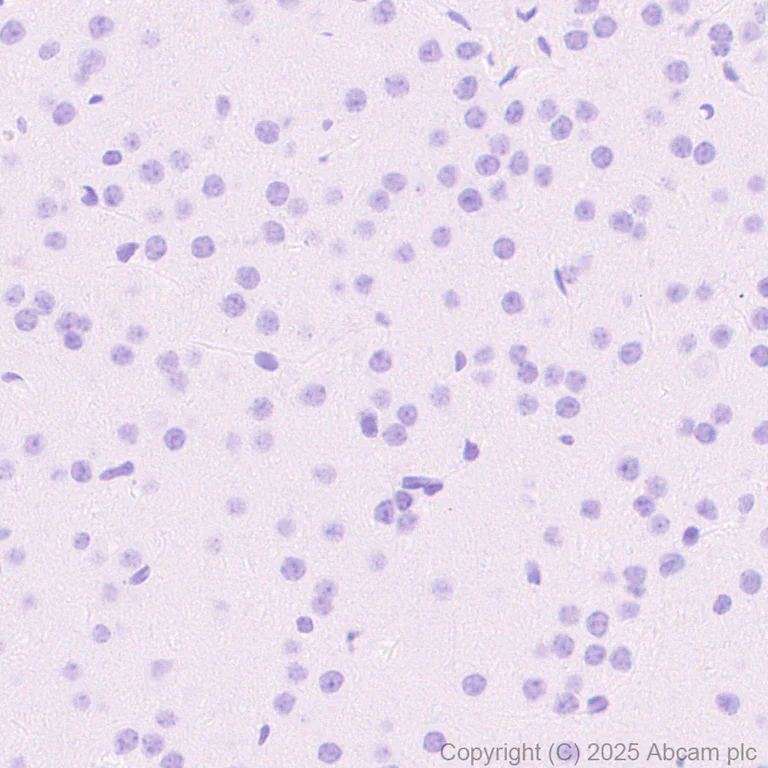Immunohistochemistry (Formalin/PFA-fixed paraffin-embedded sections) - Anti-TNF alpha antibody [EPR20972] - BSA and Azide free (AB225576)