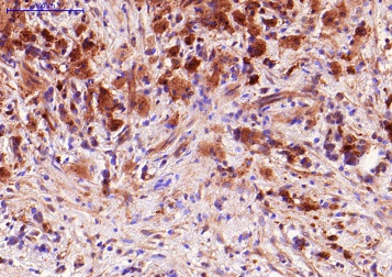 Immunohistochemistry (Formalin/PFA-fixed paraffin-embedded sections) - Anti-TNF alpha antibody [P/T2] (AB9579)