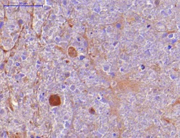 Immunohistochemistry (Formalin/PFA-fixed paraffin-embedded sections) - Anti-TNF alpha antibody [P/T2] (AB9579)