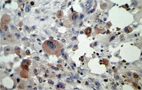 Immunohistochemistry (Formalin/PFA-fixed paraffin-embedded sections) - Anti-TNF alpha antibody [P/T2] (AB9579)