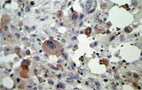 Immunohistochemistry (Formalin/PFA-fixed paraffin-embedded sections) - Anti-TNF alpha antibody [P/T2] (AB9579)