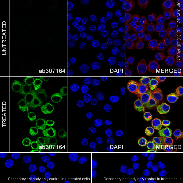 Immunocytochemistry/ Immunofluorescence - Anti-TNF alpha antibody [RM1005] (AB307164)