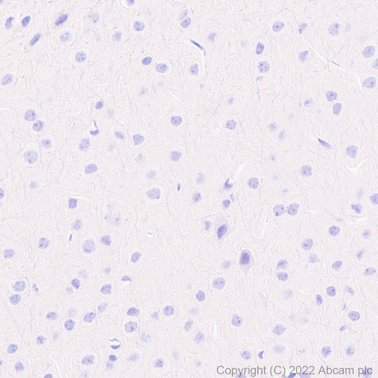 Immunohistochemistry (Formalin/PFA-fixed paraffin-embedded sections) - Anti-TNF alpha antibody [RM1005] (AB307164)