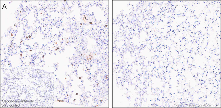 Immunohistochemistry (Formalin/PFA-fixed paraffin-embedded sections) - Anti-TNF alpha antibody [RM1005] (AB307164)