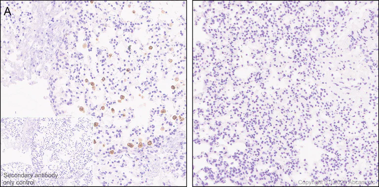 Immunohistochemistry (Formalin/PFA-fixed paraffin-embedded sections) - Anti-TNF alpha antibody [RM1005] (AB307164)