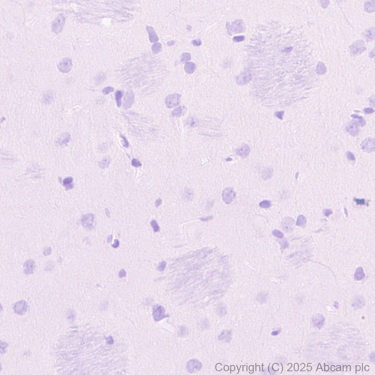 Immunohistochemistry (Formalin/PFA-fixed paraffin-embedded sections) - Anti-TNF alpha antibody [RM1005] (AB307164)