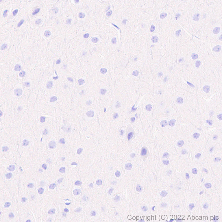 tnf様確認用 TNF alpha Monoclonal Antibody (MAb11) (14-7349-81)