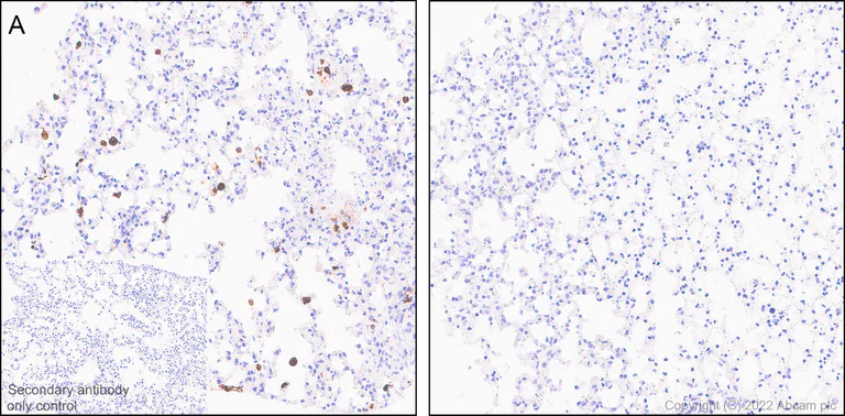 Anti-TNFA antibody [RM1005] - recombinant (ab307164) | Abcam