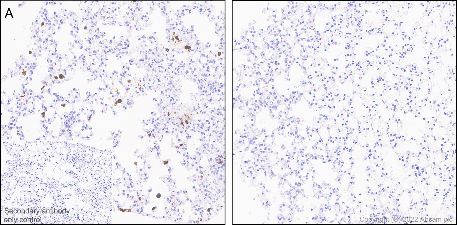 【おまけ付】 Anti-TNF alpha antibody [RM1005] - BSA and Azide free パンツ