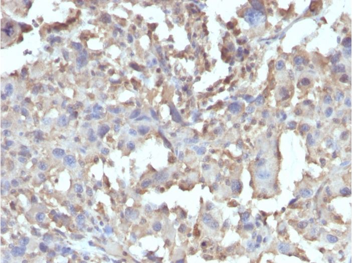 Immunohistochemistry (Formalin/PFA-fixed paraffin-embedded sections) - Anti-TNF alpha antibody [TNF/1500R] (AB270264), expandable thumbnail