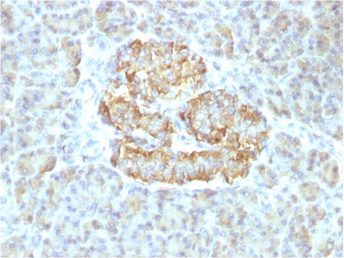 Immunohistochemistry (Formalin/PFA-fixed paraffin-embedded sections) - Anti-TNF alpha antibody [TNF/1500R] (AB270264), expandable thumbnail