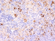 Immunohistochemistry (Formalin/PFA-fixed paraffin-embedded sections) - Anti-TNF alpha antibody [TNF706 + P/T2] - BSA and Azide free (AB212899)