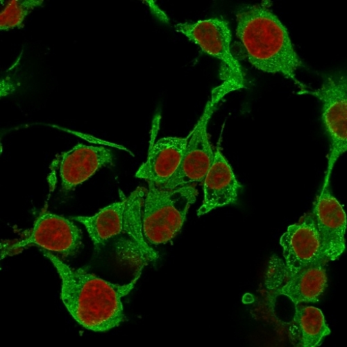 Immunocytochemistry - Anti-TNF alpha antibody [TNFA/1172] (AB220210), expandable thumbnail