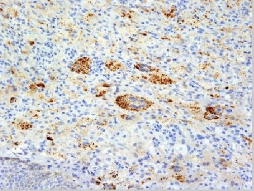 Immunohistochemistry (Formalin/PFA-fixed paraffin-embedded sections) - Anti-TNF alpha antibody [TNFA/1172] (AB220210), expandable thumbnail