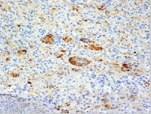 Immunohistochemistry (Formalin/PFA-fixed paraffin-embedded sections) - Anti-TNF alpha antibody [TNFA/1172] (AB220210)