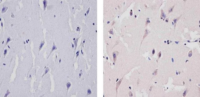 Immunohistochemistry (Formalin/PFA-fixed paraffin-embedded sections) - Anti-TNF Receptor I antibody [12HCLC] (AB277793)