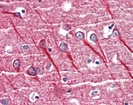 Immunohistochemistry (Formalin/PFA-fixed paraffin-embedded sections) - Anti-TNF Receptor I antibody (AB111119)