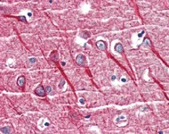 Immunohistochemistry (Formalin/PFA-fixed paraffin-embedded sections) - Anti-TNF Receptor I antibody (AB111119)