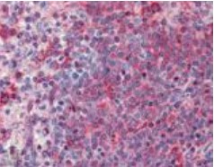 Immunohistochemistry (Formalin/PFA-fixed paraffin-embedded sections) - Anti-TNF Receptor I antibody (AB19139), expandable thumbnail