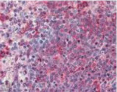 Immunohistochemistry (Formalin/PFA-fixed paraffin-embedded sections) - Anti-TNF Receptor I antibody (AB19139)