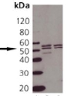 Western blot - Anti-TNF Receptor I antibody (AB19139), expandable thumbnail