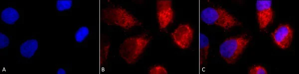 Immunocytochemistry/ Immunofluorescence - Anti-TNF Receptor I antibody (AB223352)