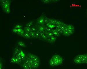 Immunocytochemistry/ Immunofluorescence - Anti-TNF Receptor I antibody (AB223352)