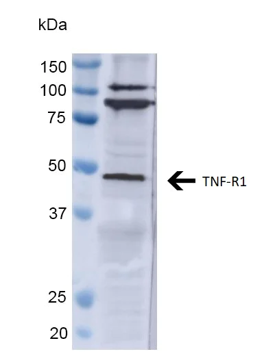Western blot - Anti-TNF Receptor I antibody (AB223352)