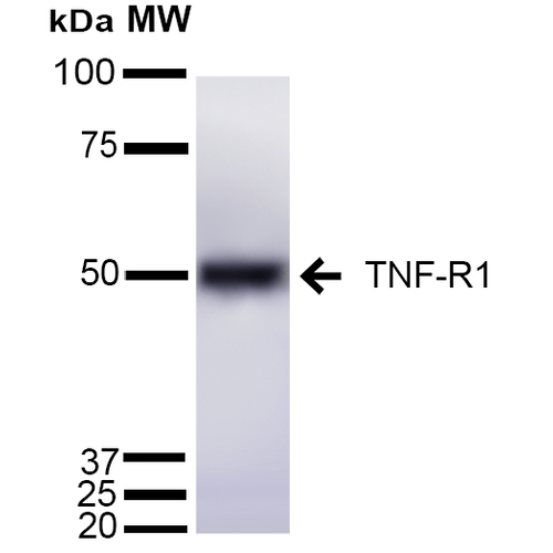 Western blot - Anti-TNF Receptor I antibody (AB223352)