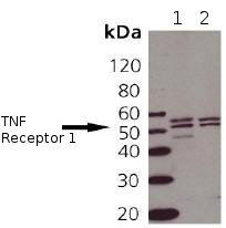 Western blot - Anti-TNF Receptor I antibody (AB90463)