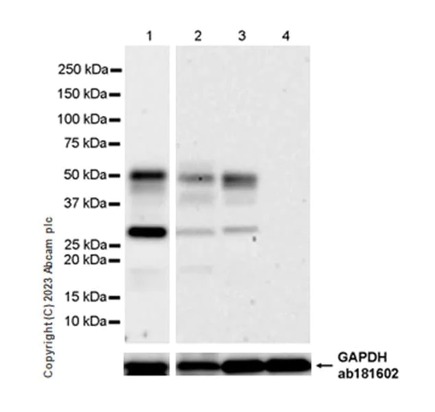 Western blot - Anti-TNF Receptor I antibody [EPR26198-14] - BSA and Azide free (AB308507)