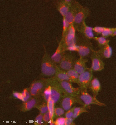 Immunocytochemistry/ Immunofluorescence - Anti-TNF Receptor II antibody [MR2-1] (AB8161), expandable thumbnail