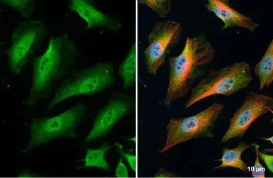 Immunocytochemistry/ Immunofluorescence - Anti-TNFAIP2 antibody (AB155256)