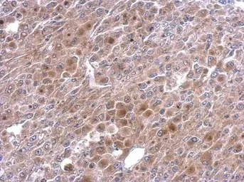 Immunohistochemistry (Formalin/PFA-fixed paraffin-embedded sections) - Anti-TNFAIP2 antibody (AB155256)