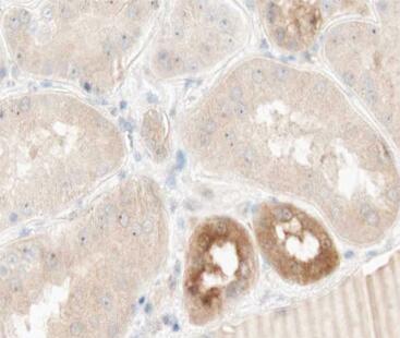 Immunohistochemistry (Formalin/PFA-fixed paraffin-embedded sections) - Anti-TNFAIP2 antibody (AB196659)