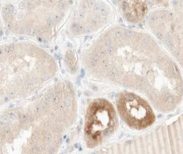 Immunohistochemistry (Formalin/PFA-fixed paraffin-embedded sections) - Anti-TNFAIP2 antibody (AB196659)