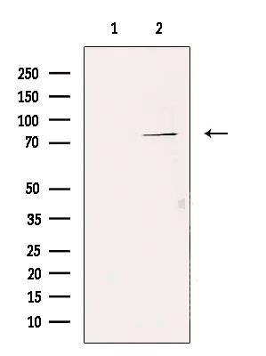 Western blot - Anti-TNFAIP2 antibody (AB196659)
