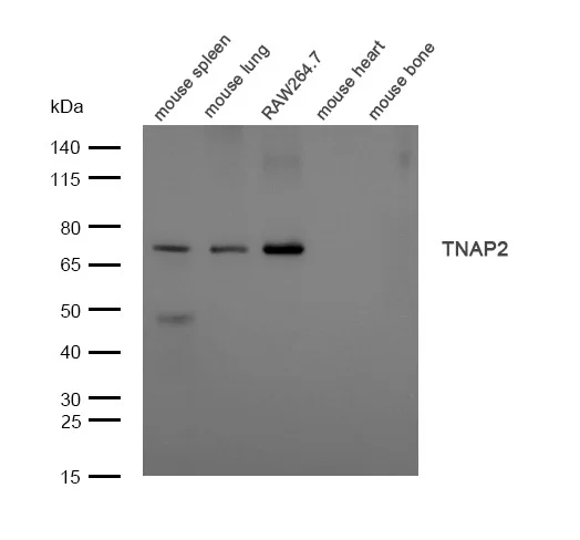 Western blot - Anti-TNFAIP2 antibody (AB196659)
