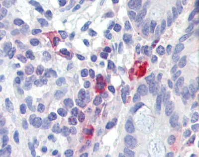 Immunohistochemistry (Formalin/PFA-fixed paraffin-embedded sections) - Anti-TNFAIP3 antibody (AB111192)