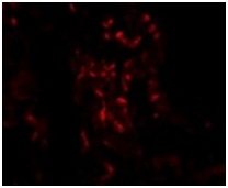 Immunocytochemistry/ Immunofluorescence - Anti-TNFAIP3 antibody (AB193462), expandable thumbnail