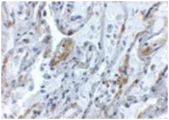 Immunohistochemistry (Formalin/PFA-fixed paraffin-embedded sections) - Anti-TNFAIP3 antibody (AB193462)